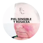 Piel sensible o rosacea